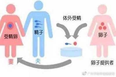 供卵试管婴儿 供卵试管婴儿